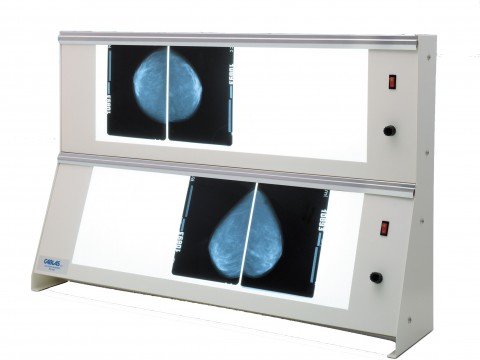 Negativoscopi per mammografia serie alta intensità