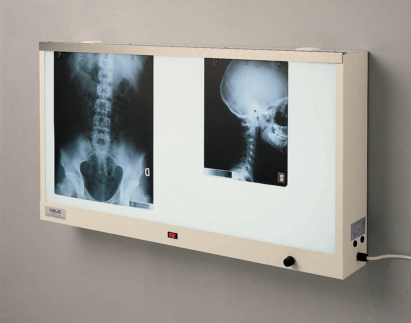 X ray film viewer wall series standards cablas schermature anti x