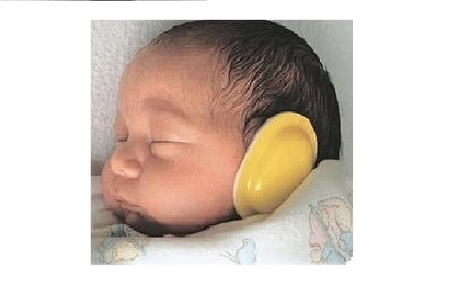 Attenuatori acustici neonatali amagnetici - monouso